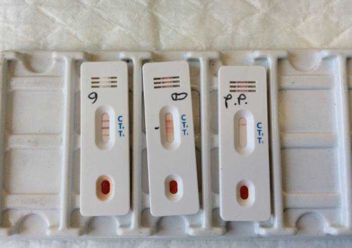 Test sierologici privati: ecco i 25 laboratori approvati dalla Regione