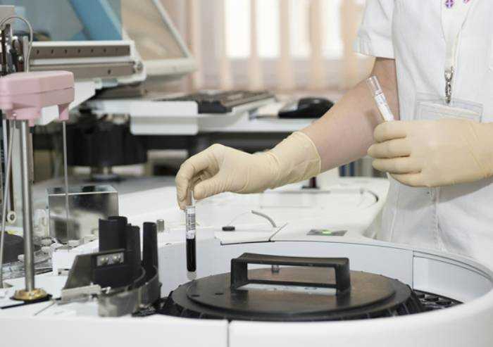 Test sierologici, ecco le regole per farli. Fissato il costo: 25 euro