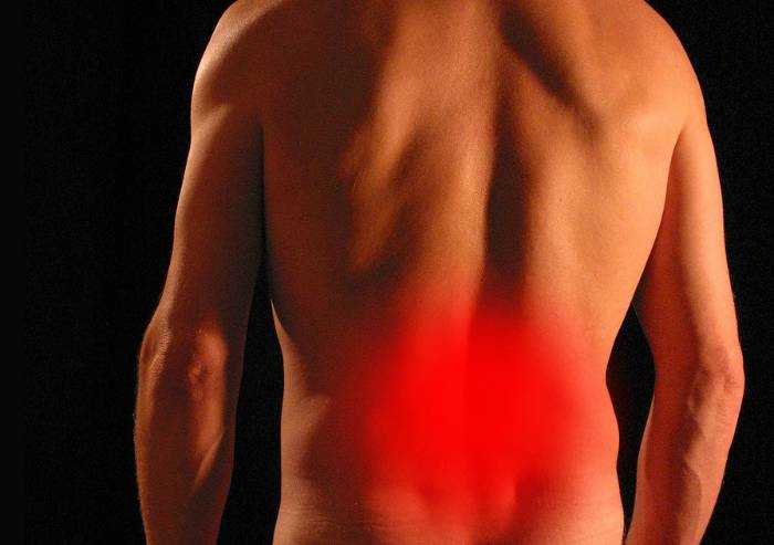 Rimedi pratici contro il mal di schiena
