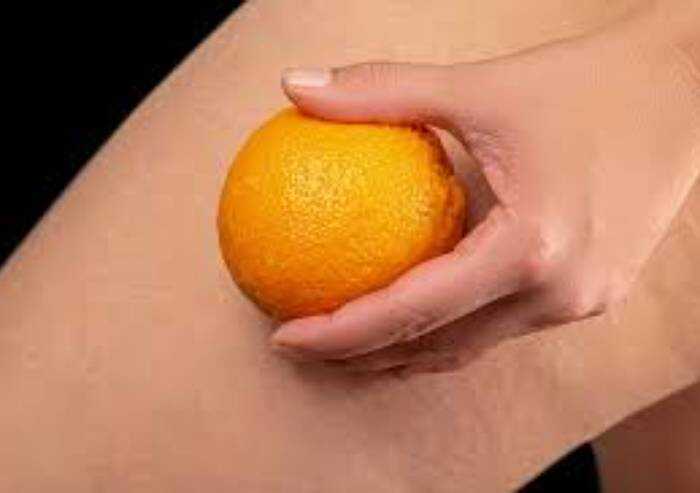 Cellulite: ecco come affrontarla