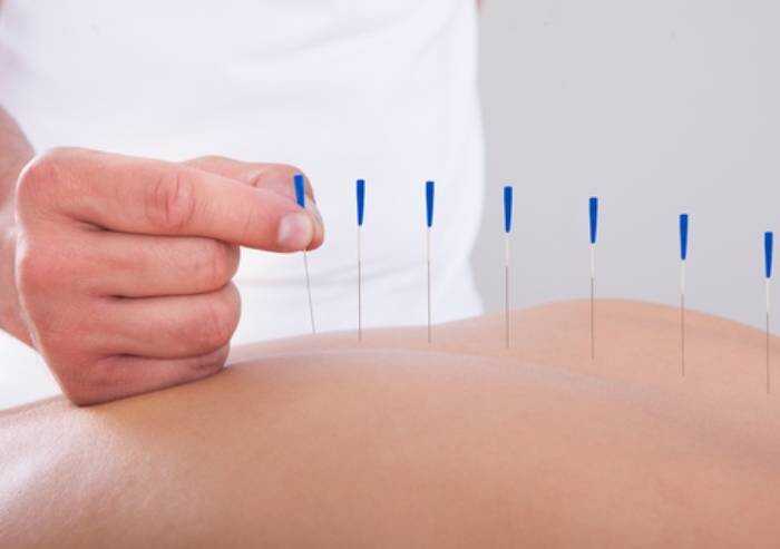 Sette domande sulla agopuntura