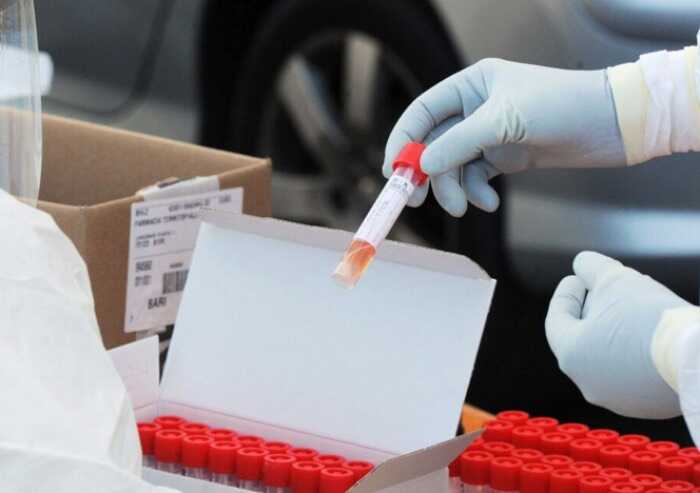 Primo caso in Italia di variante Omicron