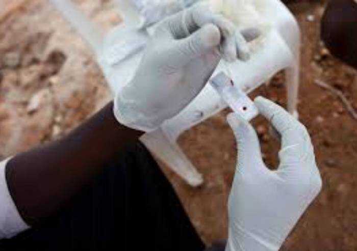 Aids: contagi e morti in continuo calo, e con la malattia ora si convive