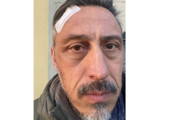 'Vignola, aggredito per aver allontanato tre persone senza green pass'