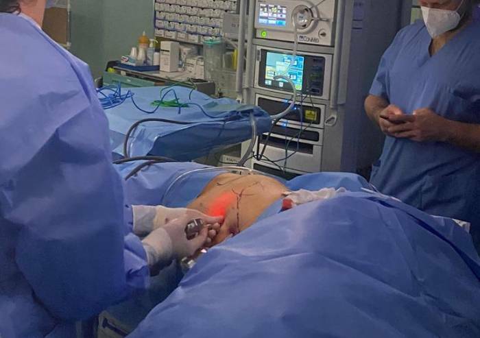 Chirurgia pediatrica: al Policlinico debuttano i robot