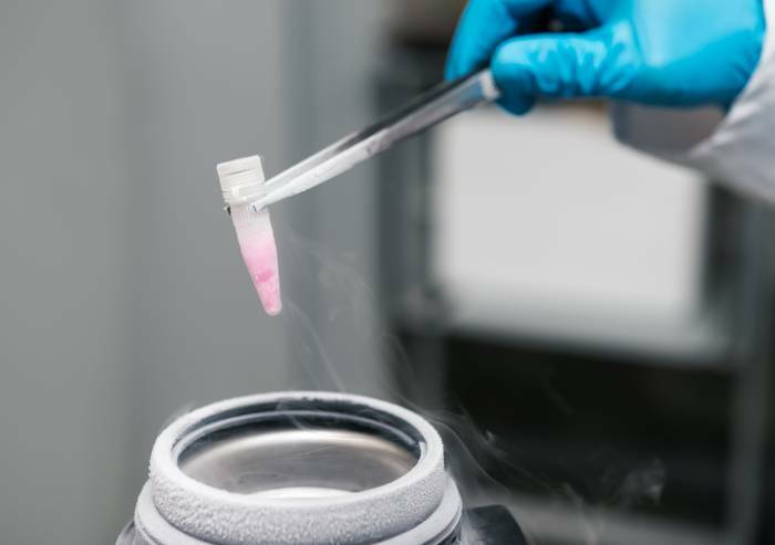 Dopo il tumore partorisce 2 gemelli con ovociti congelati 14 anni fa