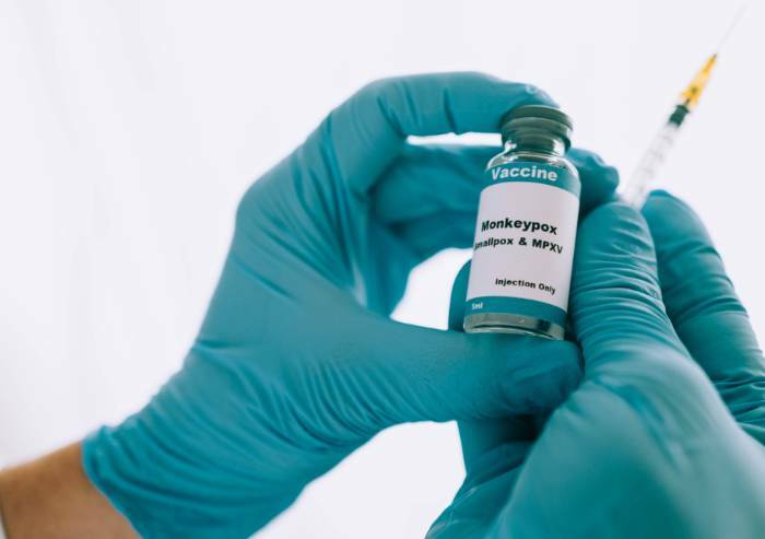 'Vaiolo delle scimmie, scorta di vaccini in Italia è sufficiente'