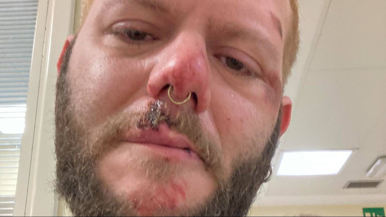 Modena, 40enne picchiato, rapinato e lasciato a terra tra insulti omofobi