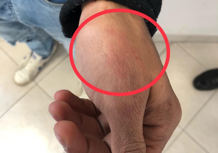 Carpi, in semilibertà aggredisce e rapina donna, che lo fa arrestare